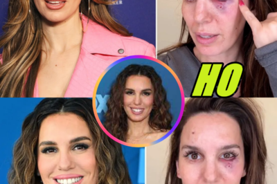 Christy Carlson Romano Hospitalized After Getting Shot in the Eye