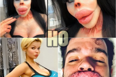 20 People Who Took Their Plastic Surgery Too Far | HO