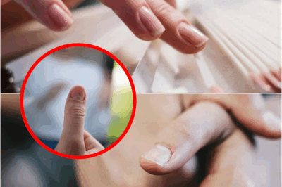 Doctor Explains What It Means If You Have Ridges On Your Fingernails – S
