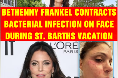 Bethenny Frankel Contracts Bacterial Infection on Face During St. Barths Vacation