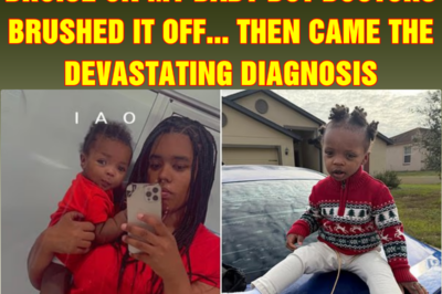 I noticed an unexplained bruise on my baby but doctors brushed it off… then came the devastating diagnosis